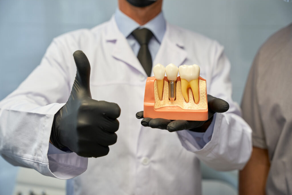 Custom Dental Implant Model for Patient Education