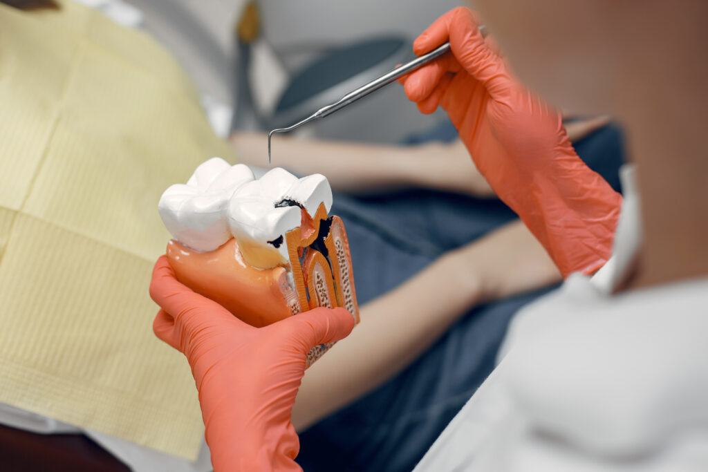 Dentist Explaining Root Canal Procedure