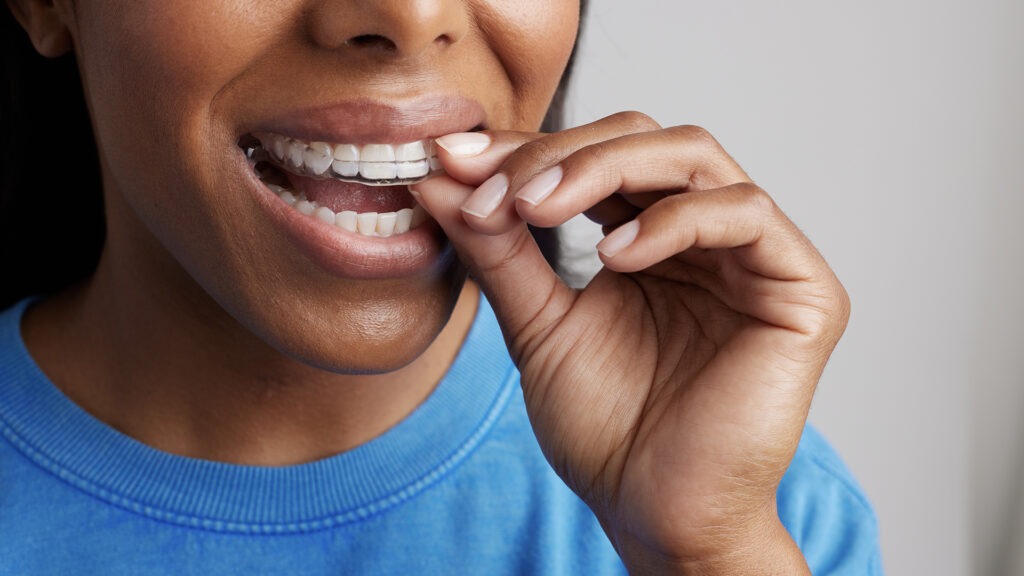 Custom ProSomnus Device Perfect Fit for Teeth